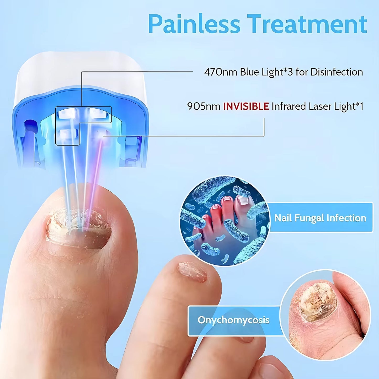 Nail Fungus Laser Treatment LED Light Device Effective Rechargeable Nail Fungus Remover Nail Fungus Cleaning Laser Device Repair Damaged Discolored Thick Fingernails