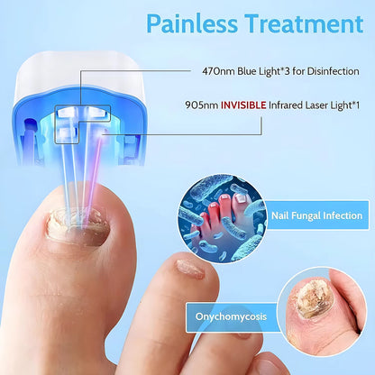 Nail Fungus Laser Treatment LED Light Device Effective Rechargeable Nail Fungus Remover Nail Fungus Cleaning Laser Device Repair Damaged Discolored Thick Fingernails